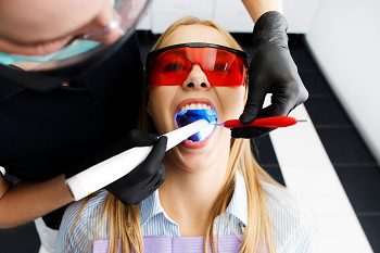 Benefits of In-office Teeth Whitening Procedure 