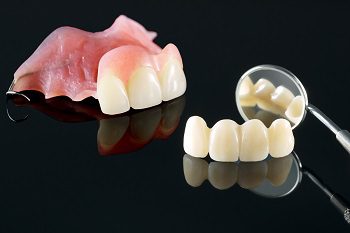Partial Dentures Vs. Fixed Implant Bridges: Which One to Consider?