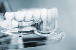 Dental Technology Just Keeps Getting Better