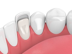 Have Regular Dental Checkups