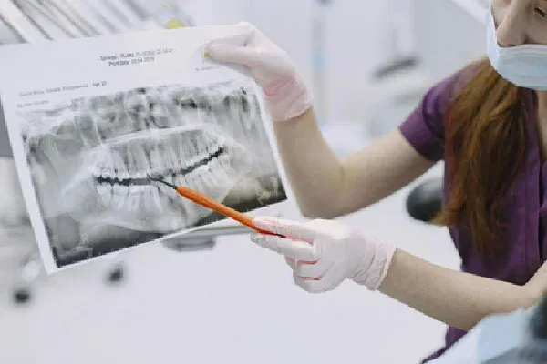 Dental Implant