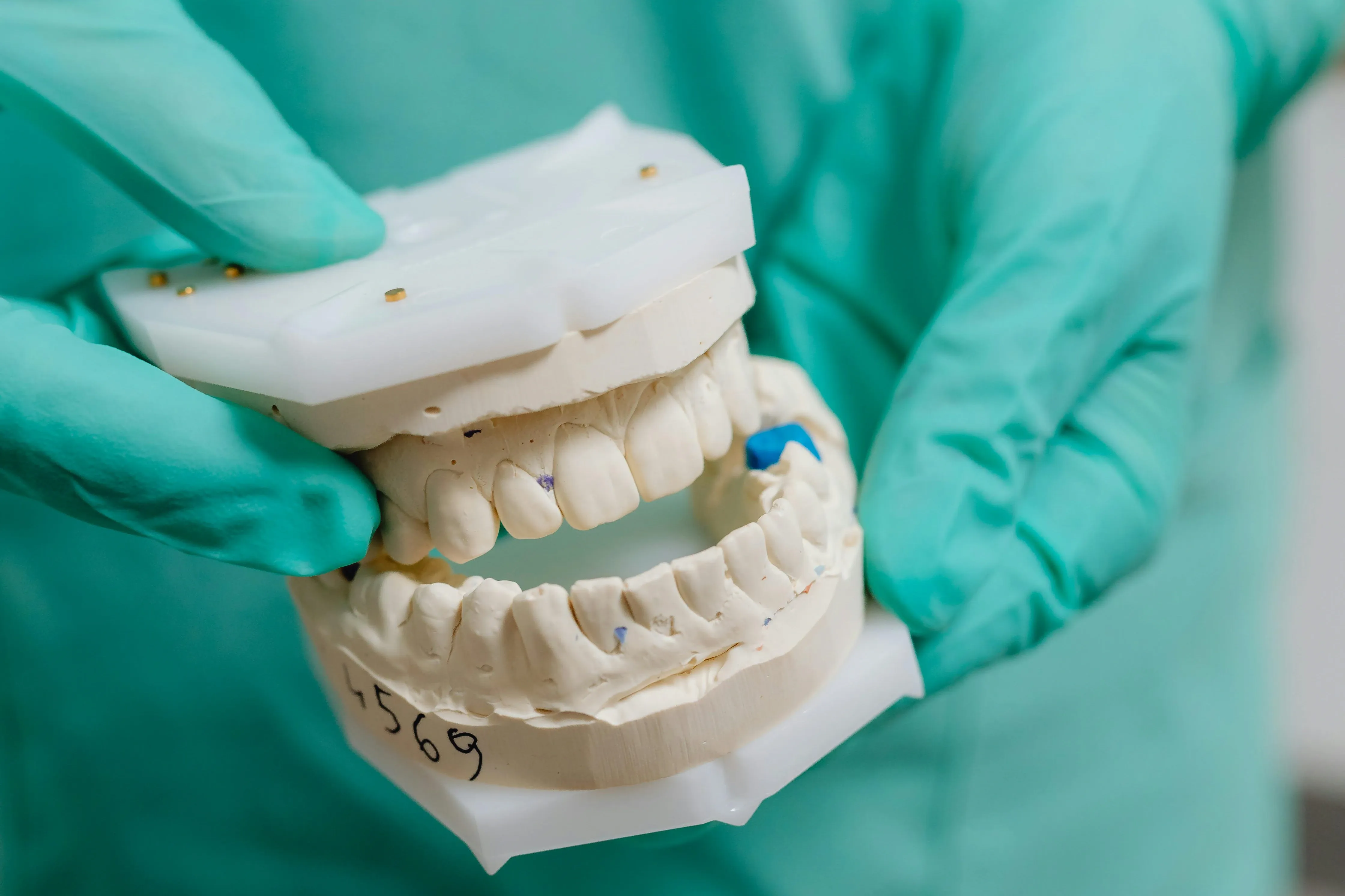 dental implant