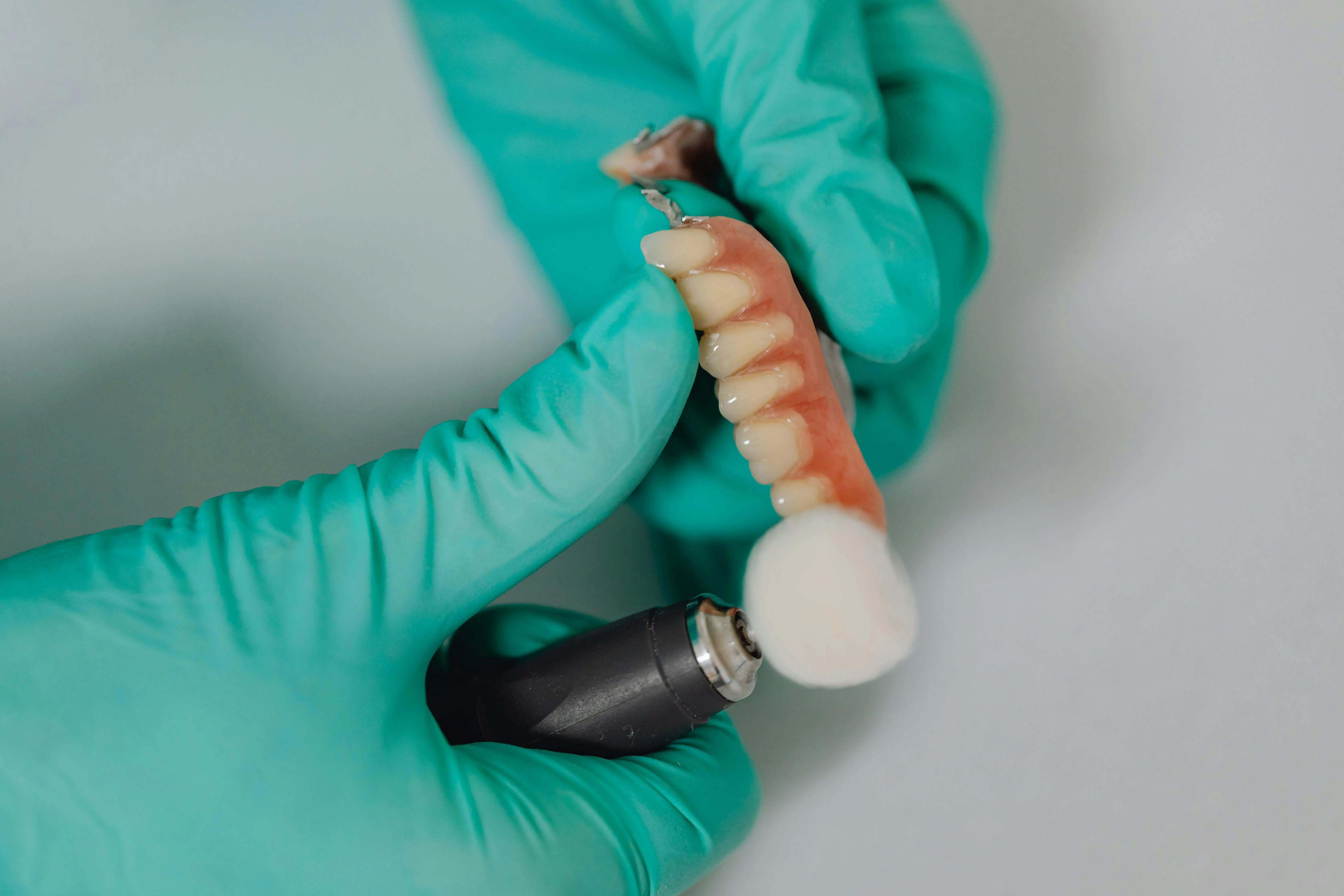 Dental implants