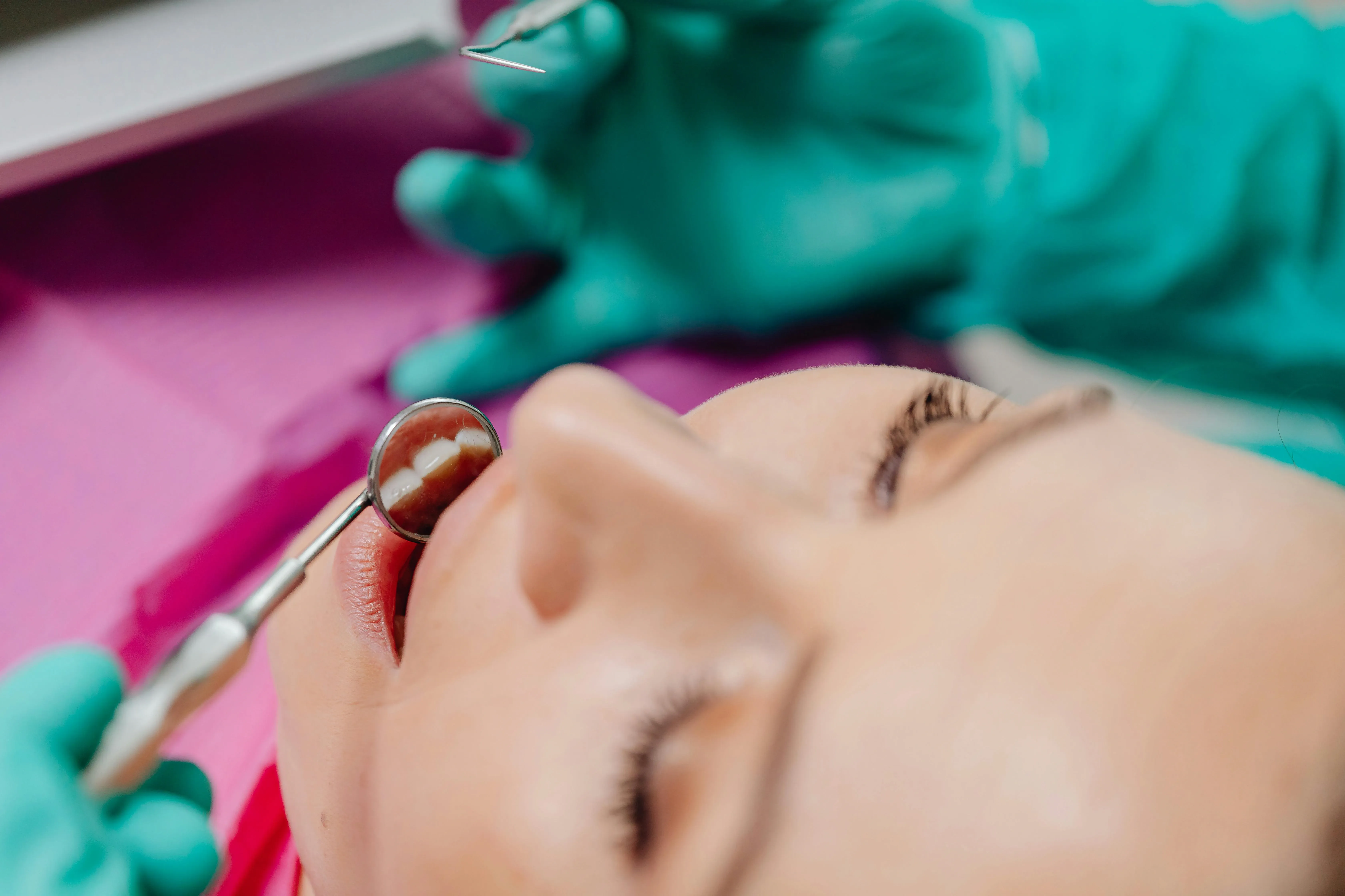 Dental implants
