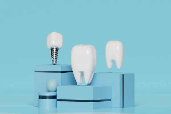 Dental Implant