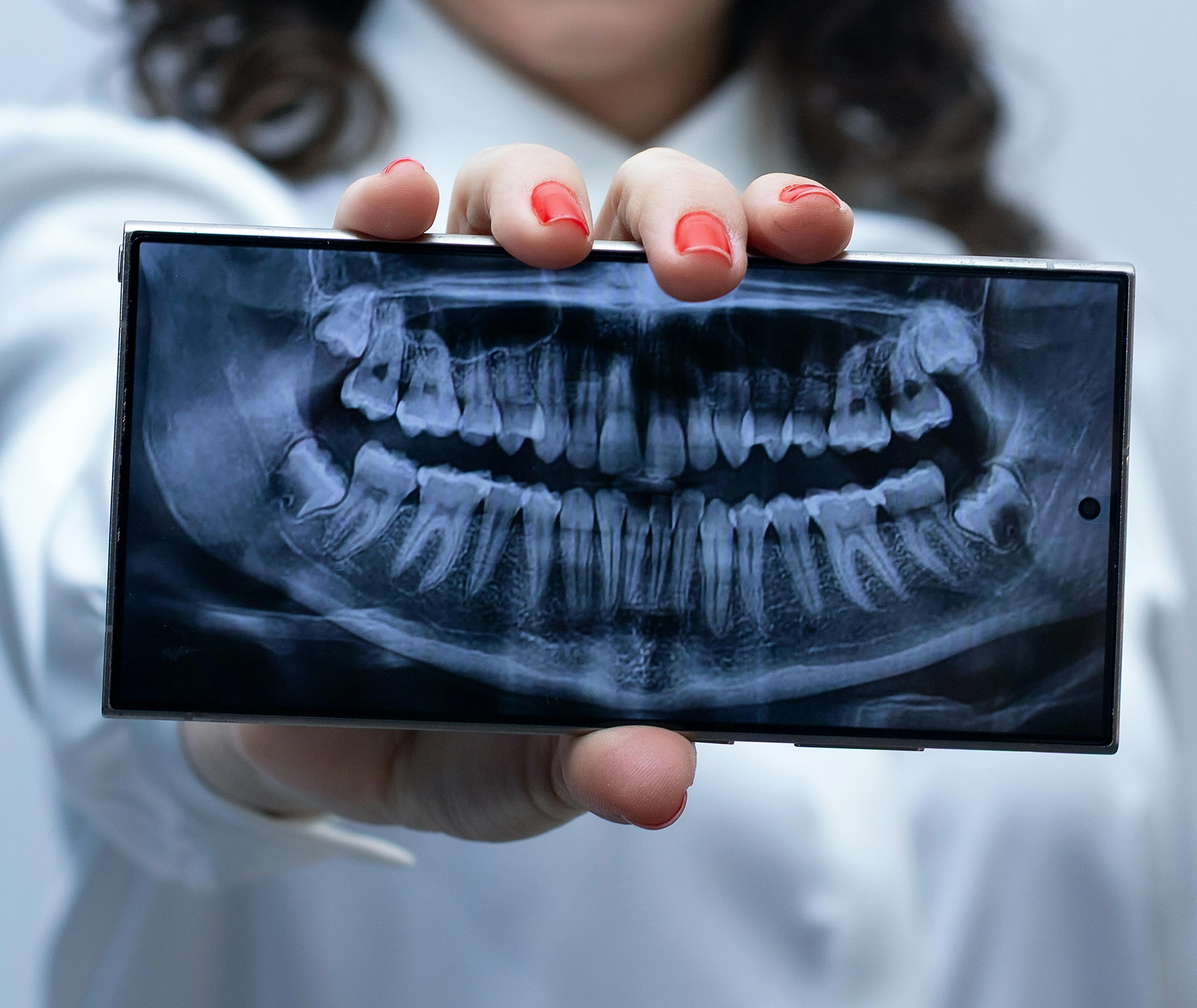 Dental implants