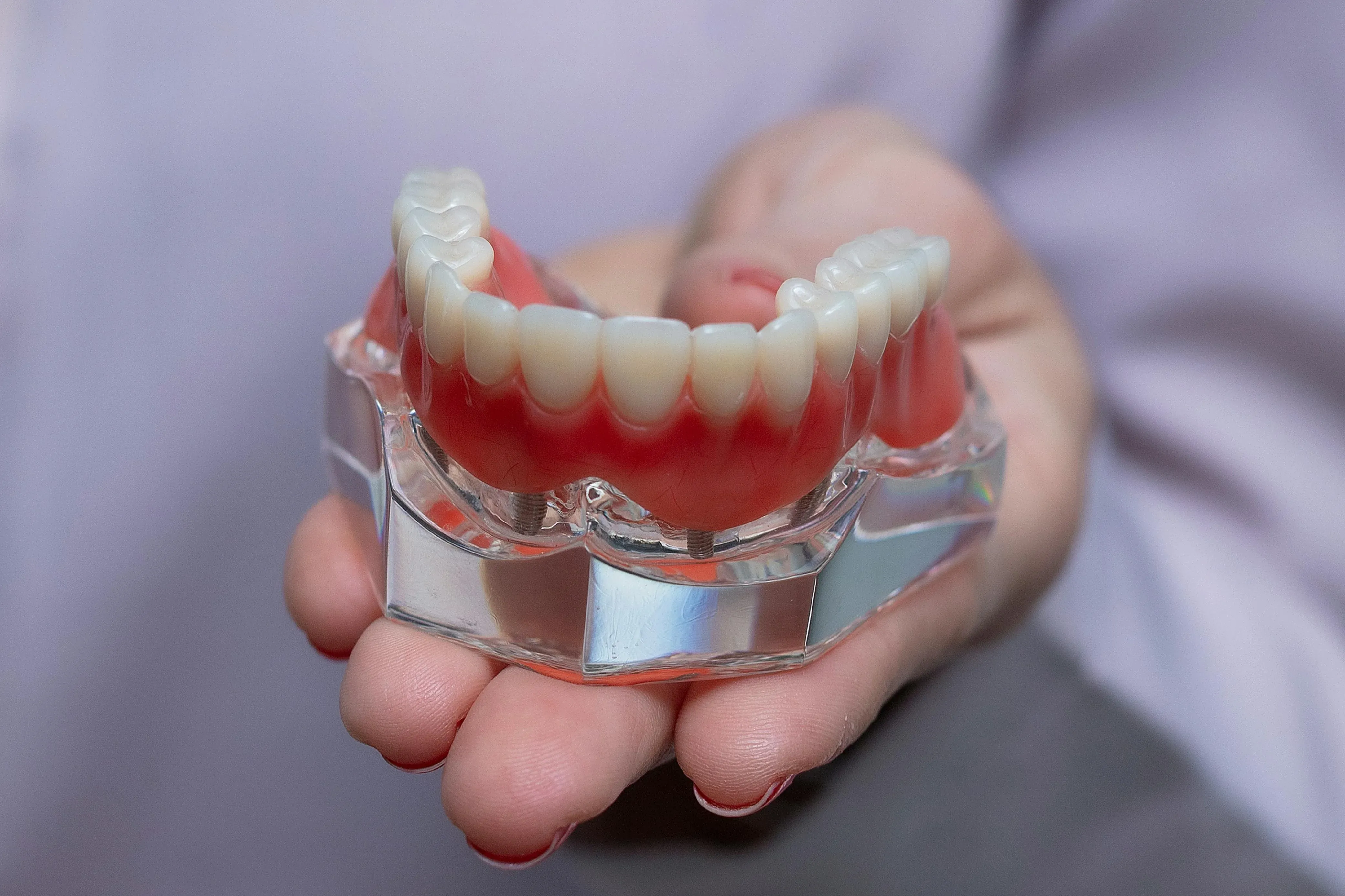 Dental implant
