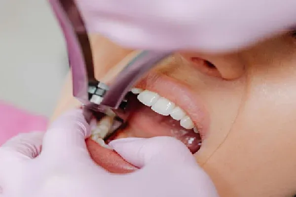 Dental implant