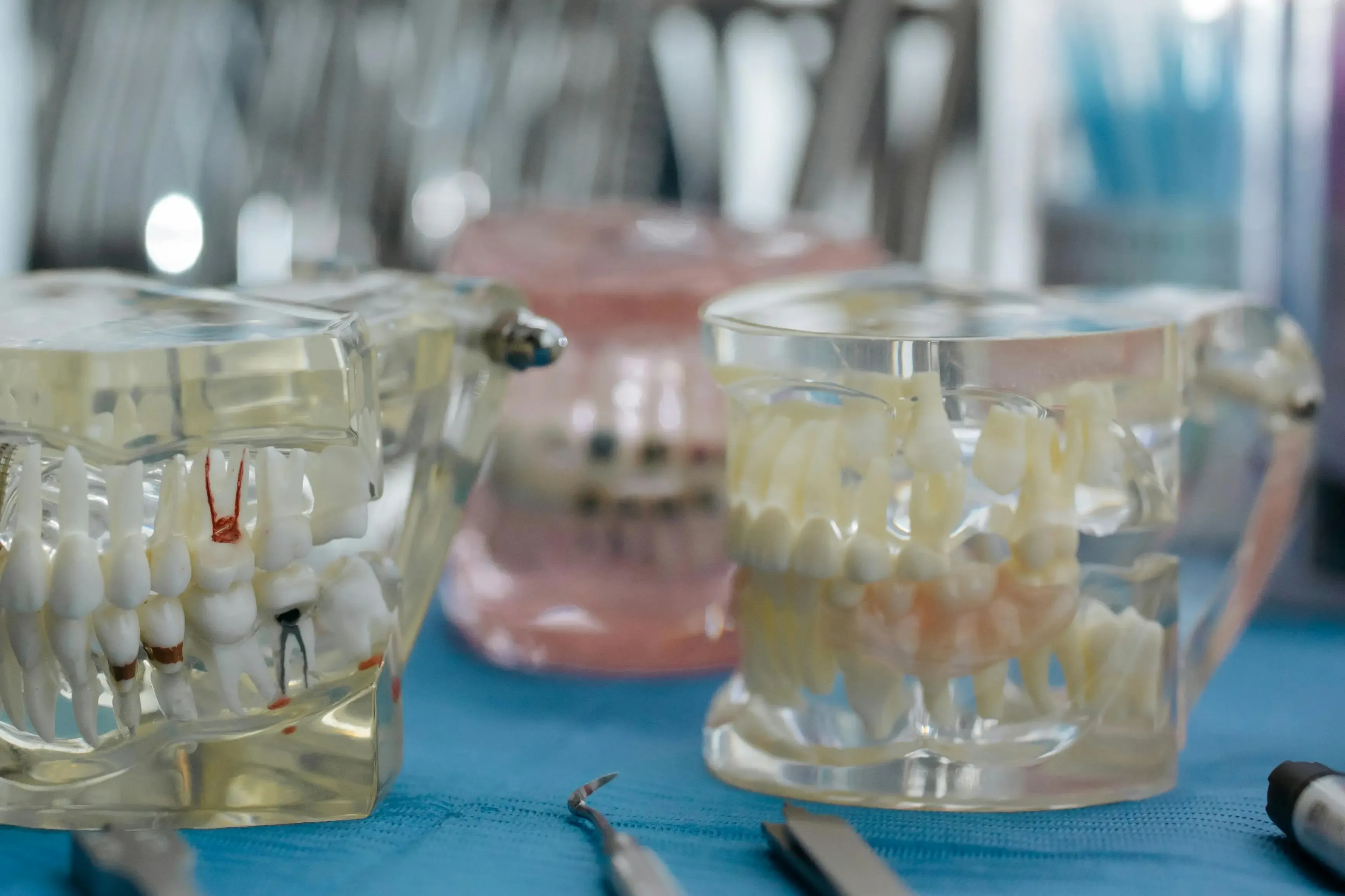 Dental implants