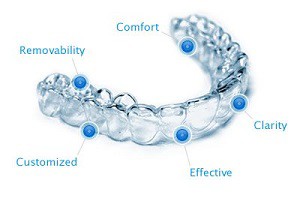 How Does Invisalign Work