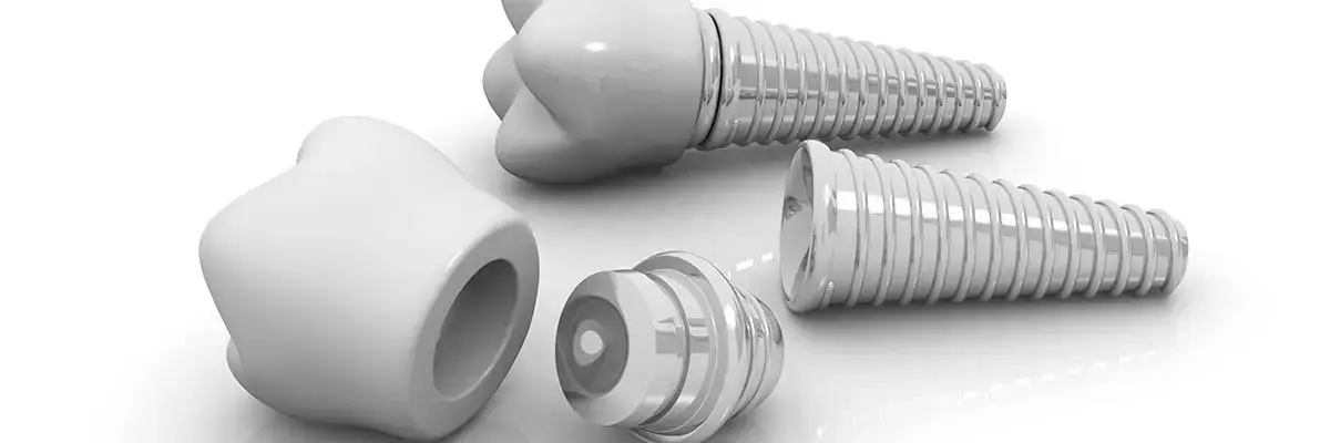 Dental Implants in Walnut Creek, CA