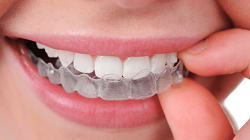 Why People Choose Orthodontics