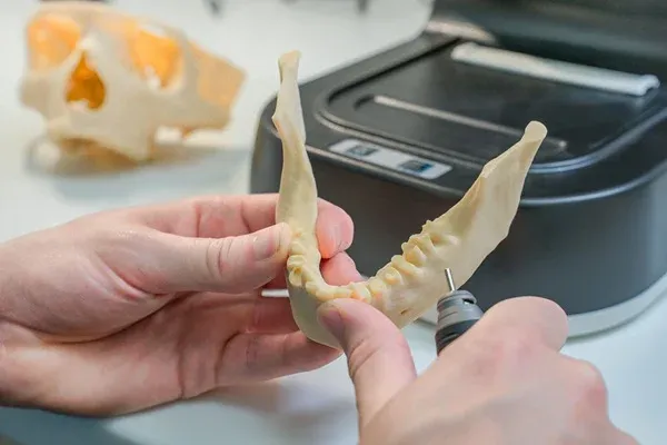Mini implant