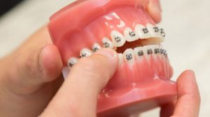 What is Orthodontics and What Does an Orthodontist Do?