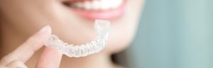 Changing Aligners