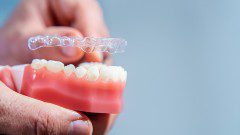 Treatment Phases of Orthodontic Care 