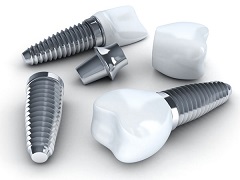 What Affects The Cost of Dental Implant Placement?