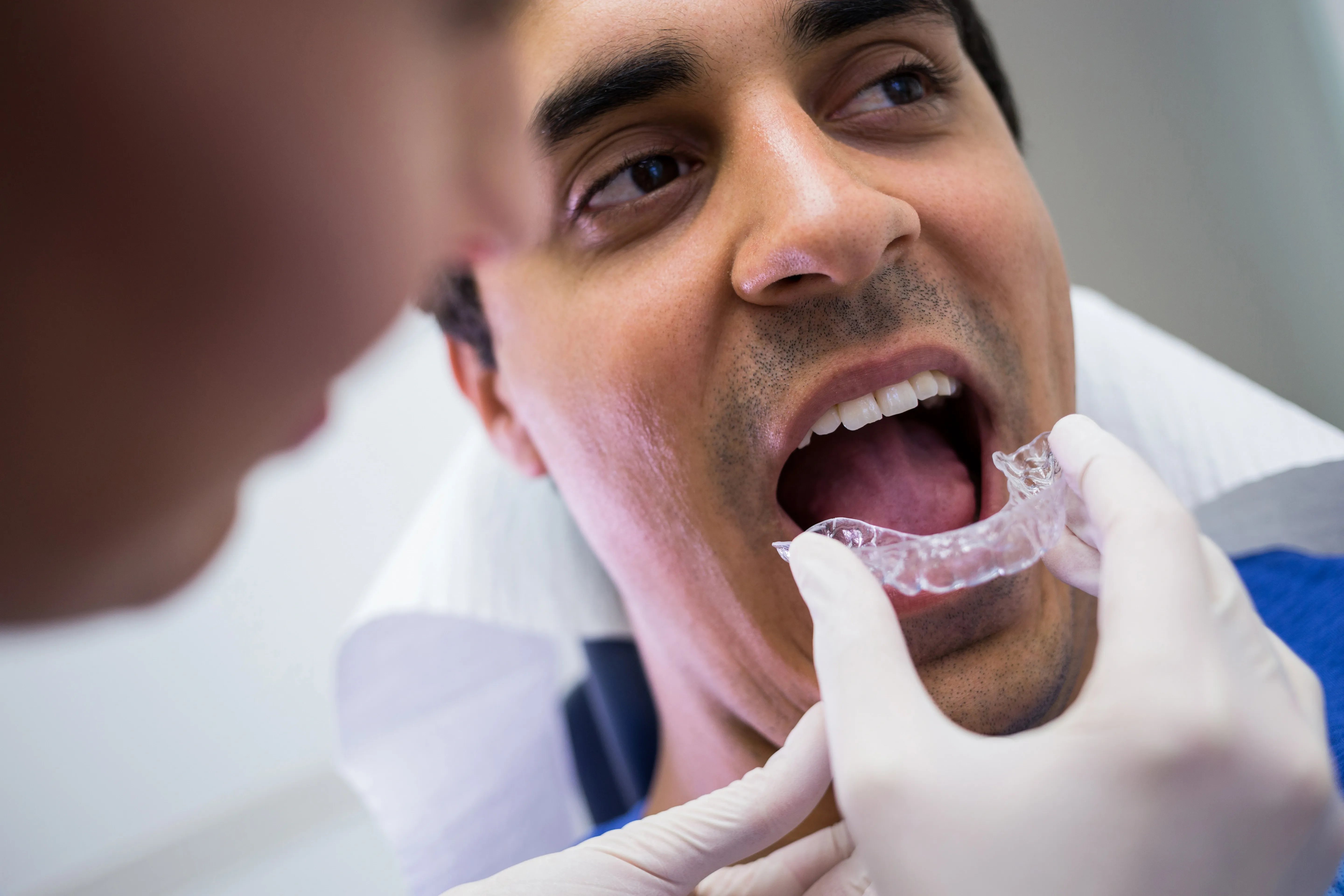 Invisalign treatment