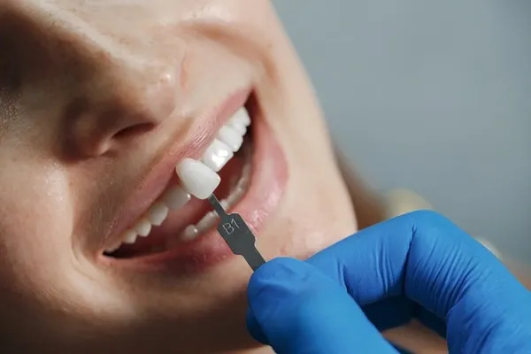 Dental Implant