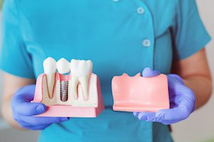 Have Better Dental Health Going Forward 